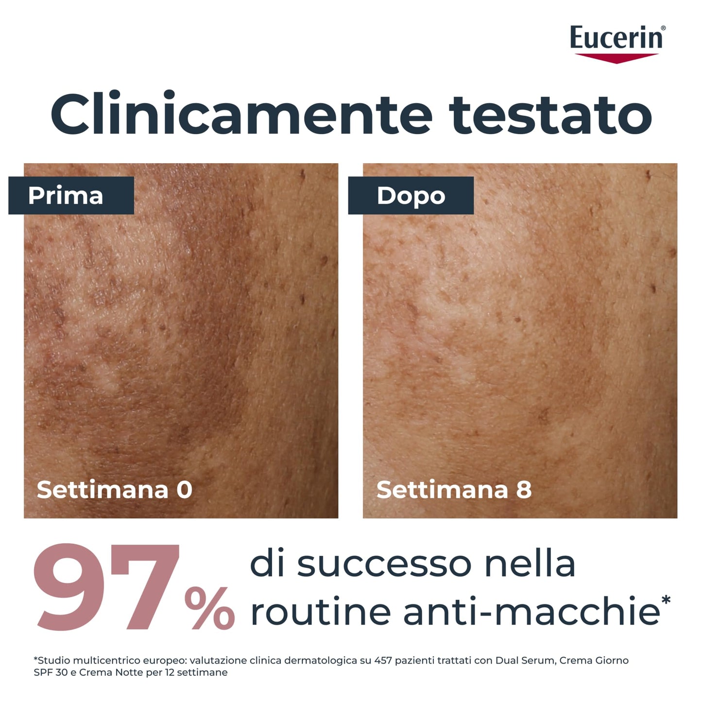 Eucerin Anti-Pigment Tag LSF 30 Creme, 50 ml Crema